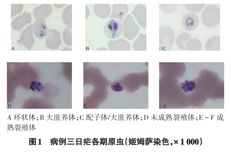 捕获疟原镜检(1)